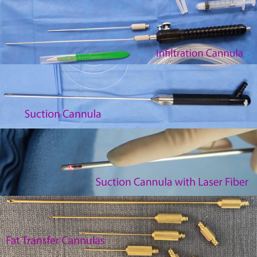 La Cánula de Liposucción: Una Varita Mágica - Avellanet Surgical Aesthetics